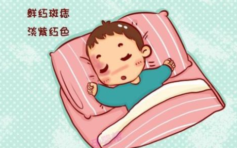 红色胎记是什么命（红色胎记有什么寓意）