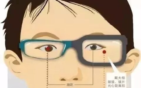 配眼镜瞳距有误差后果是（瞳距是什么）