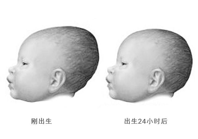 囟门怎么读（囟门是什么意思）