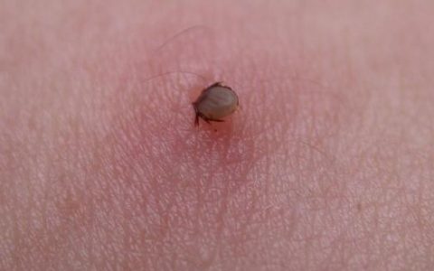 蜱虫是什么样的（怎么消灭蜱虫的方法）